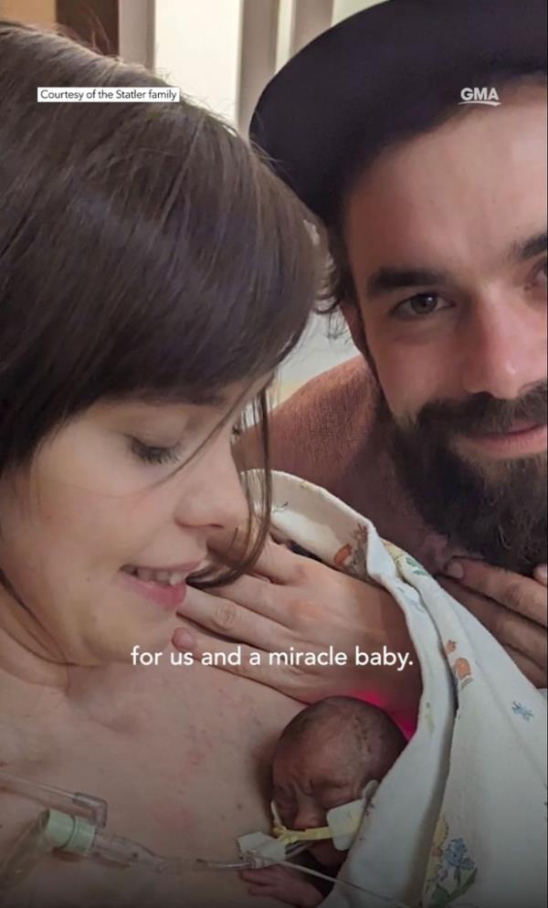 Evie was born four mo<em></em>nths early, and o<em></em>nly weighing just 14 ounces.